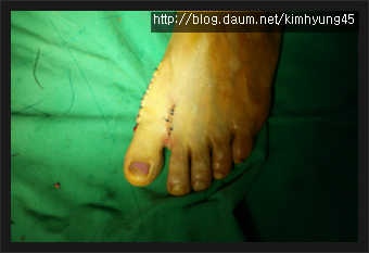 분홍색발톱의 절규