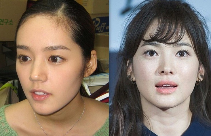 나의 여자 취향은? 전자 VS 후자 .JPG | 인스티즈